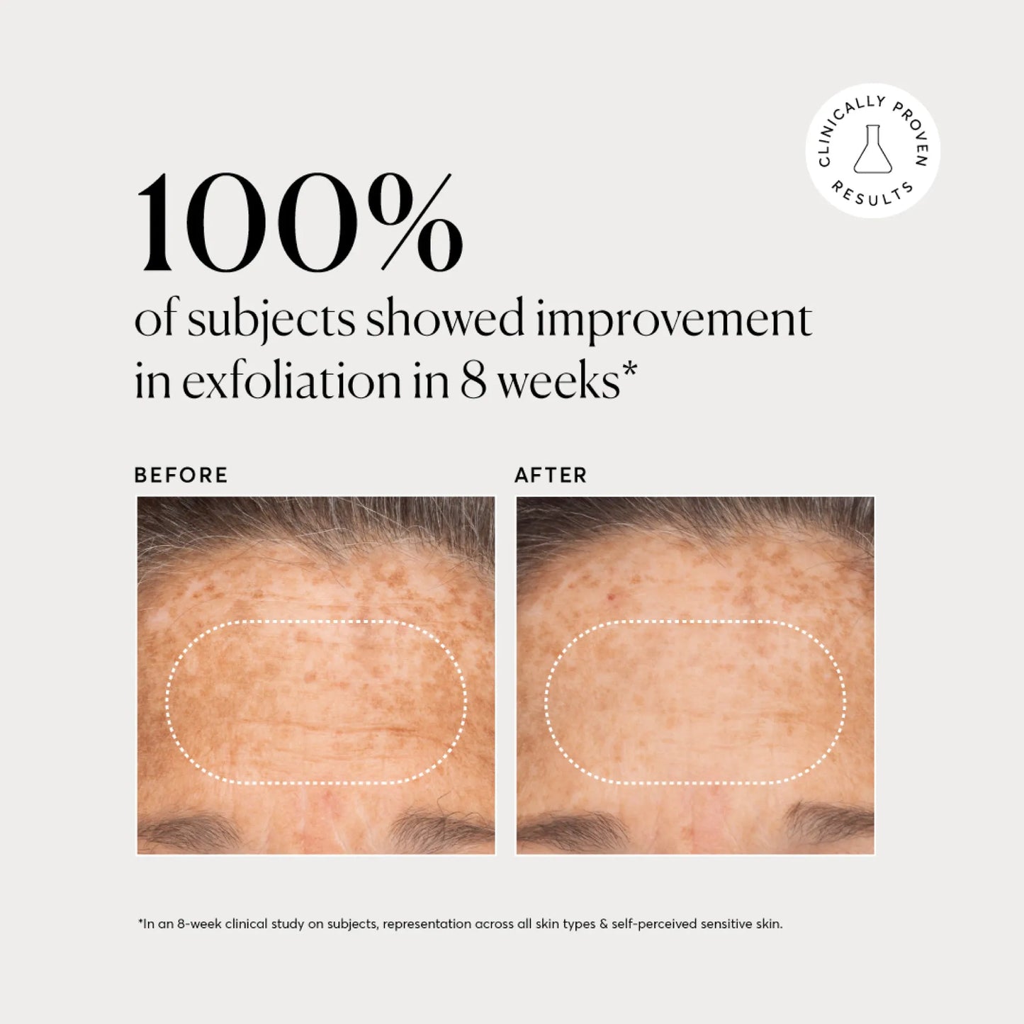 bha-liquid-exfoliant-2-b9 NATR-10027-Alt-Images-BHA-Liquid-Exfoliant-2_-03.webp