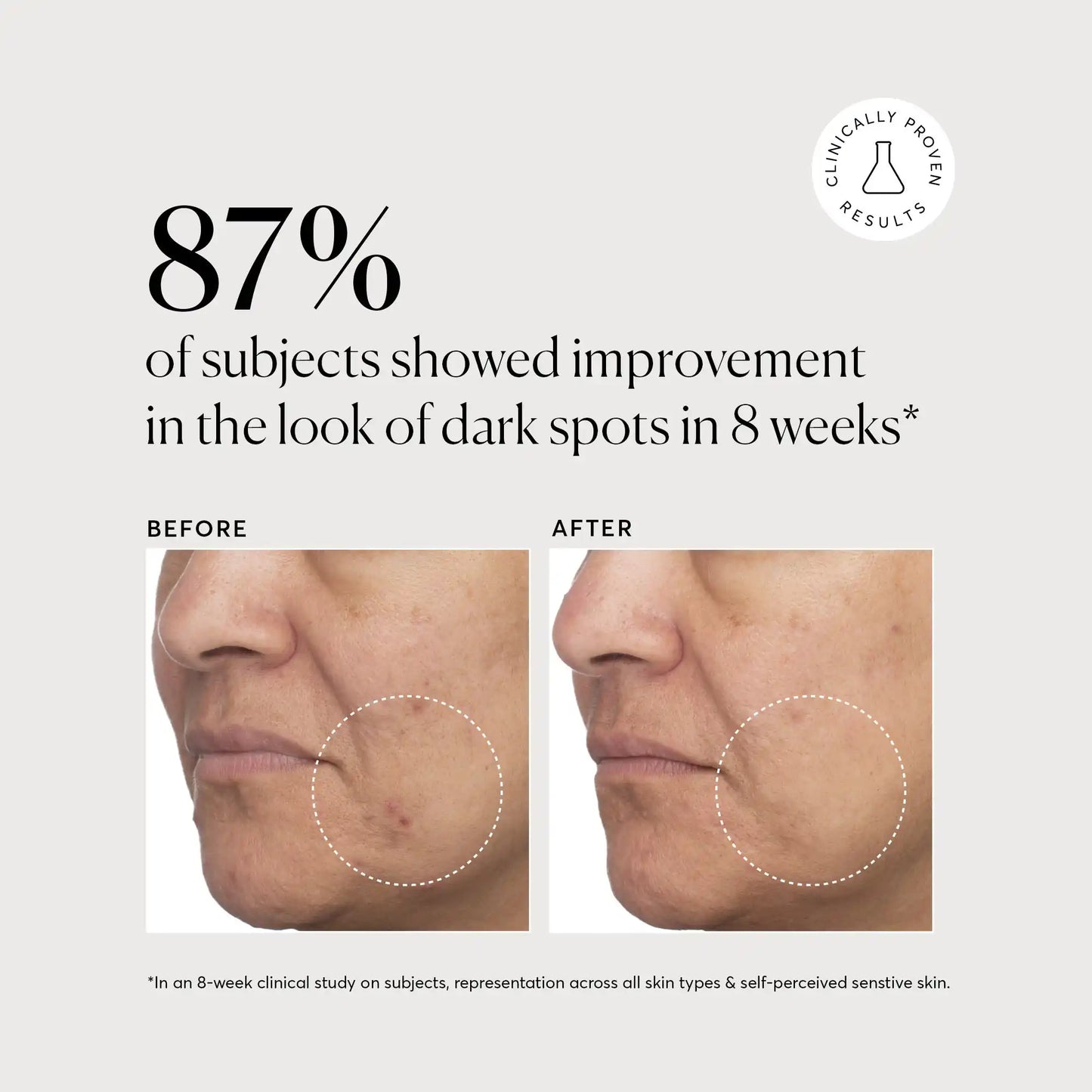 tranexamic-topical-acid-5-v0 NATR_Tranexamic_Acid_Clinical_Brighter_B_A_Bone.webp
